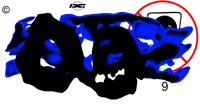 suffocation.webp